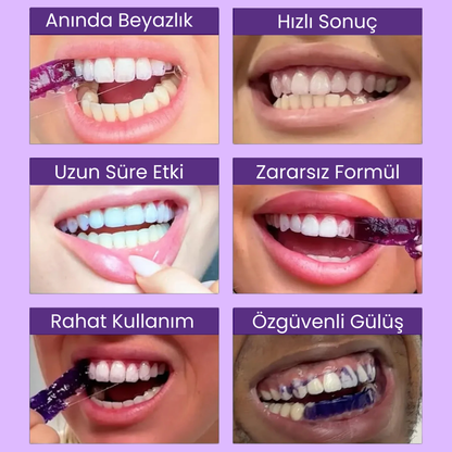 Smile Clean Diş Beyazlatma Bandı