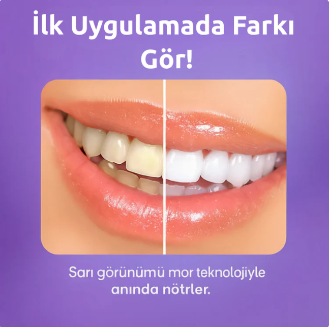 Smile Clean Diş Beyazlatma Bandı